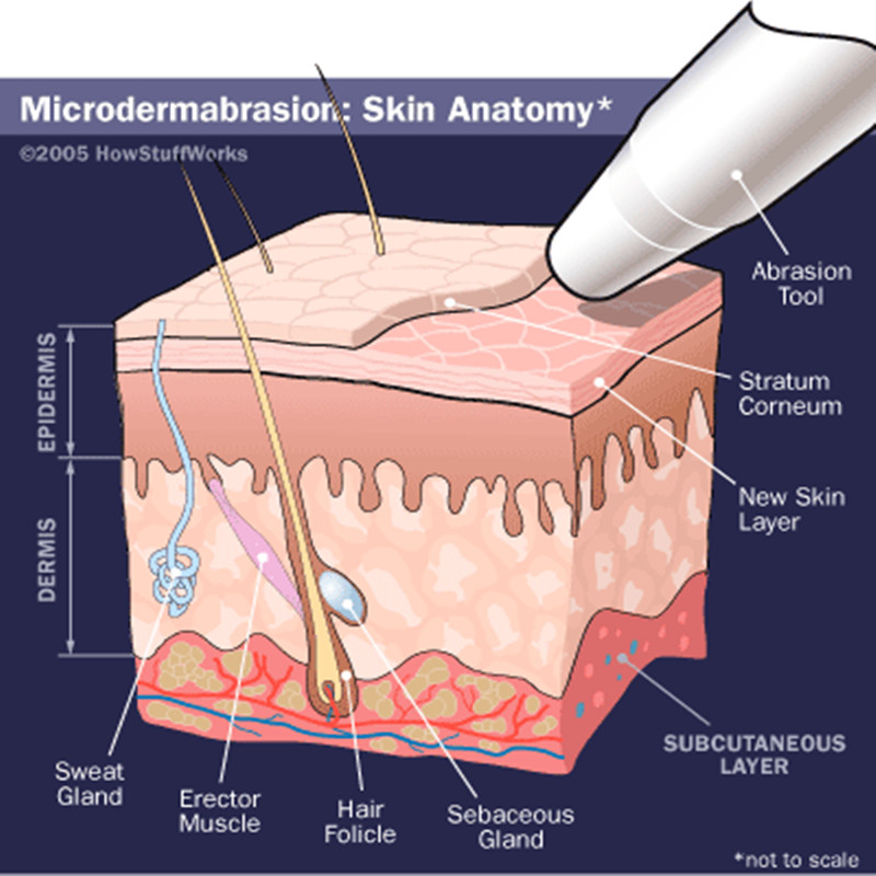 Vânzare fierbinte Microdermabraziune Diamant Peeling Beauty Machine Factory Vânzare directă