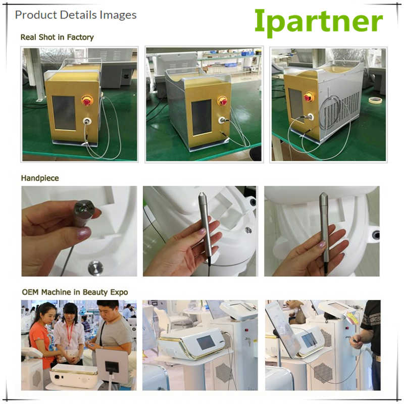 Laserul cu diode Ipartner LS980 eliberează sistemul de roșeață