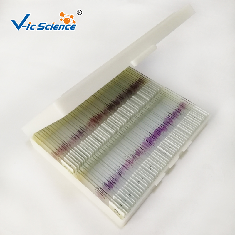 Setul de 100pcs patologie umană alunecă diapozitive microscopice pregătite