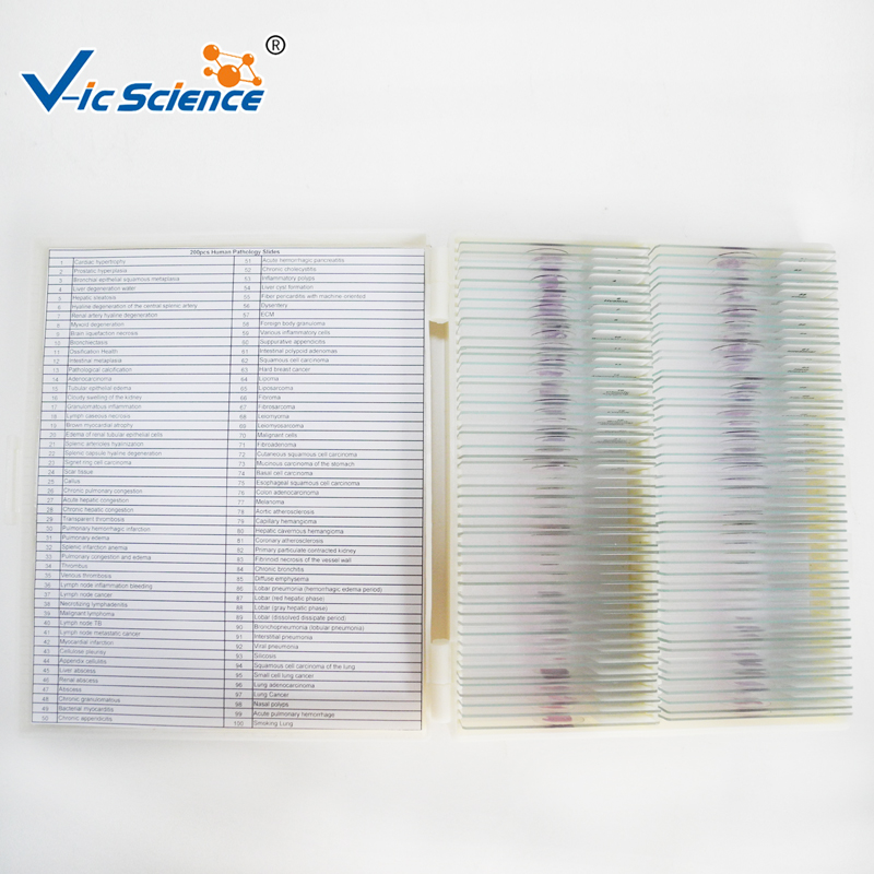 Setul de 100pcs patologie umană alunecă diapozitive microscopice pregătite
