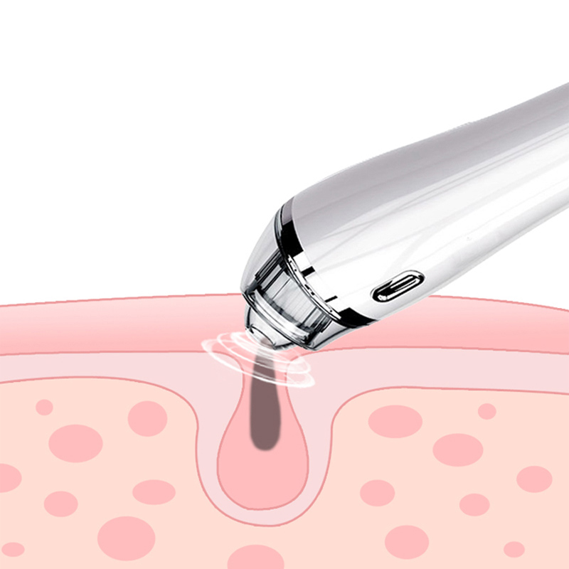 Blackhead Remover Vacuum - Purificator de curățare electrică a aspiratorului Blackhead faciale instrument de extracție a acneei pentru femei și bărbați