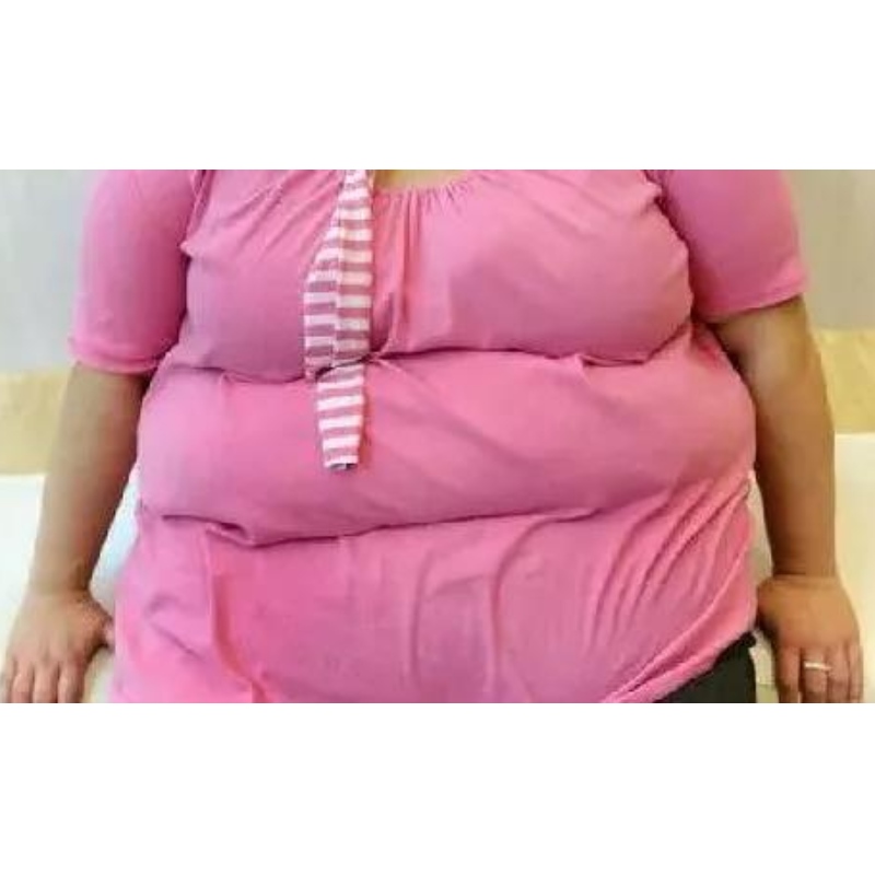 Universitatea Shizuoka: Cum NMN ajută la reducerea grăsimilor?