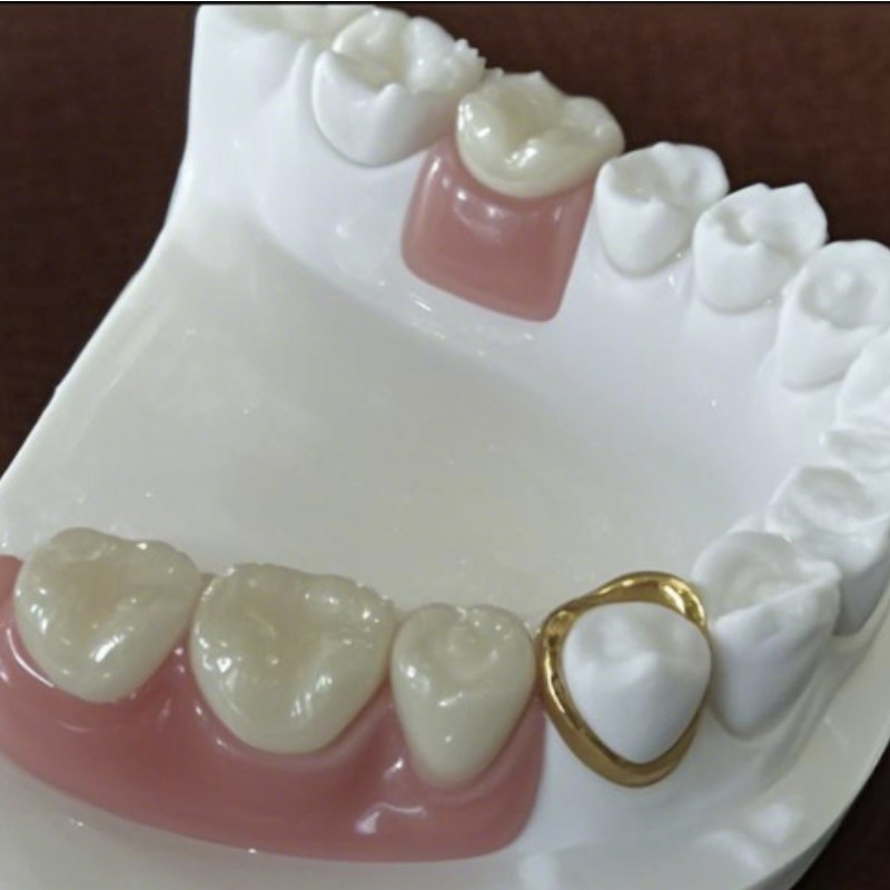 Atașament de precizie