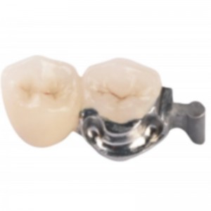 Atașament de precizie