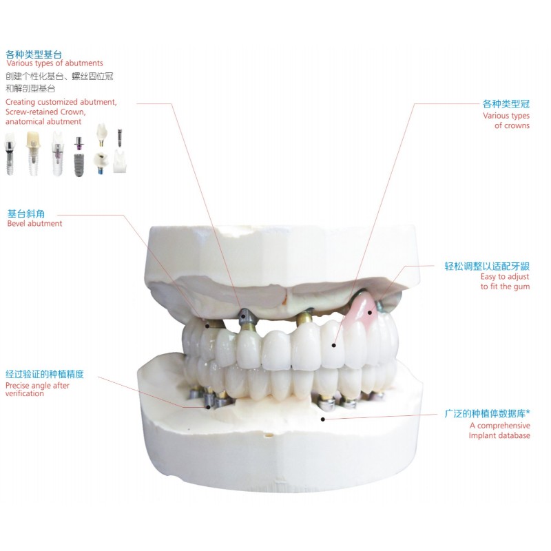 implant dentar